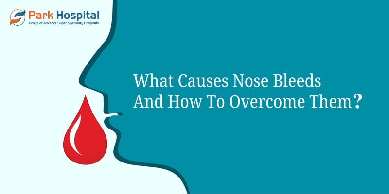 Nose bleeds and how to overcome them?